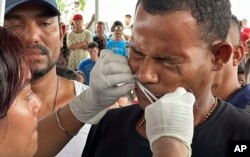 Un migrante tiene sus labios cosidos juntos como una forma de protesta para el paso legal en Huixtla, estado de Chiapas, México, jueves 2 de noviembre de 2023. (AP Photo/Edgar Hernández Clemente)e)